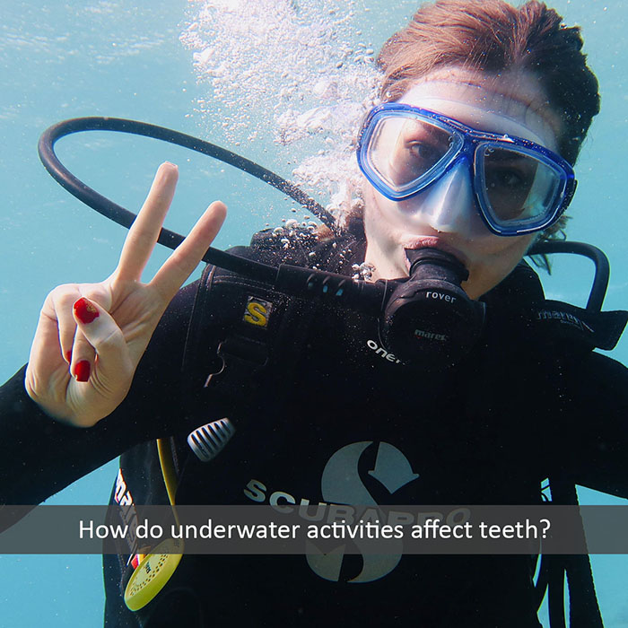 underwater teeth 2022 700 Great Northern Dental Care -Ronald Jarvis, DDS