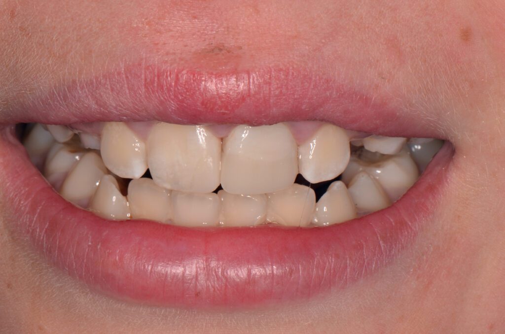 Homola Before and After Image 1 Great Northern Dental Care