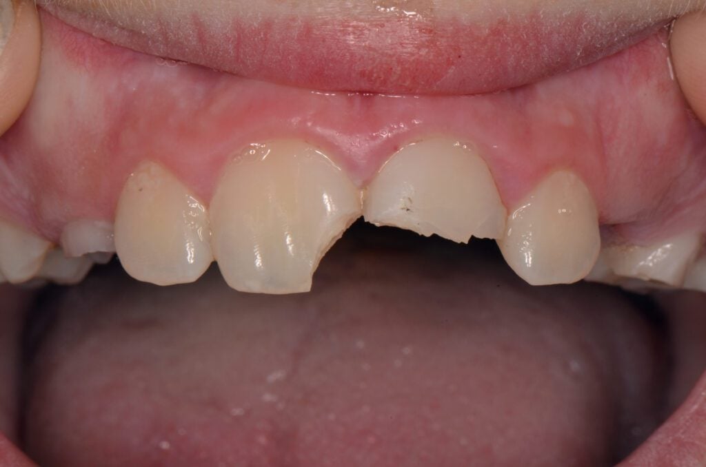 Homola Before and After Image 1 Great Northern Dental Care