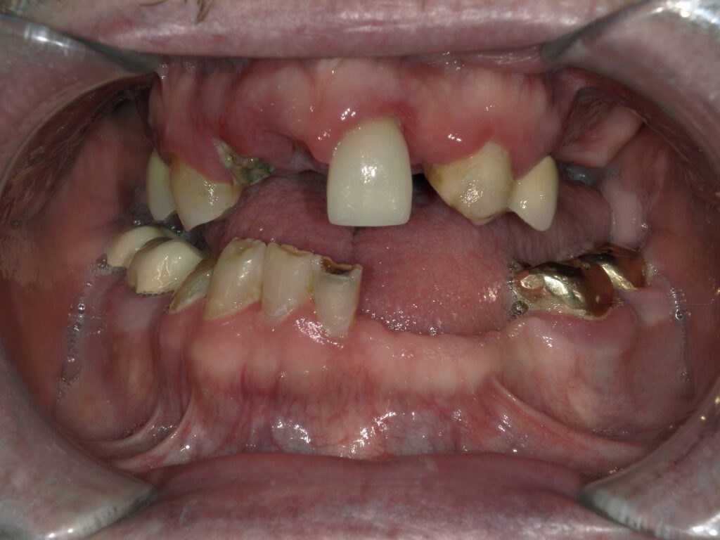 Rowe Before and After Image 1 Great Northern Dental Care