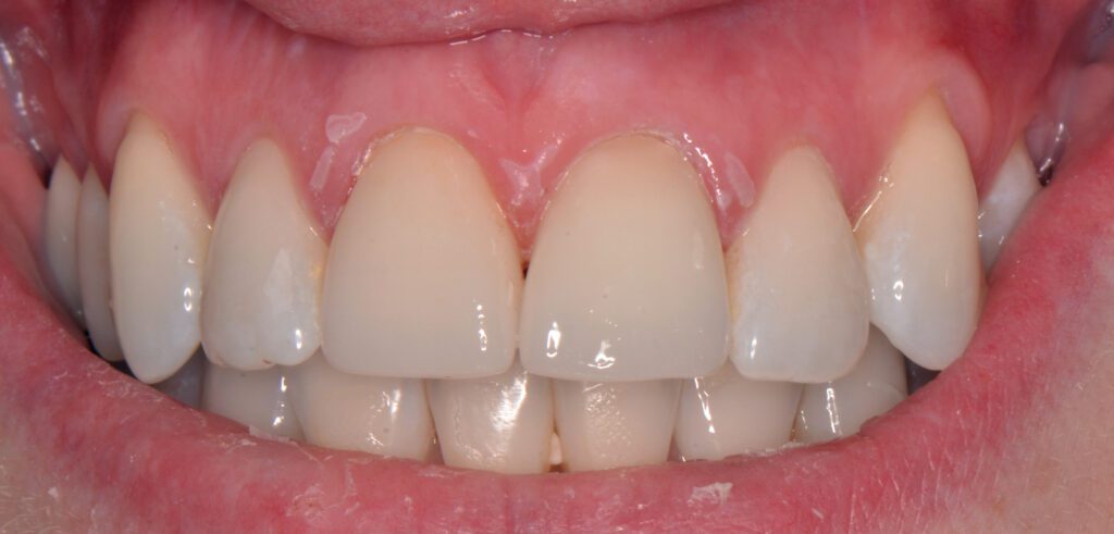 J Before and After Image 2 Great Northern Dental Care