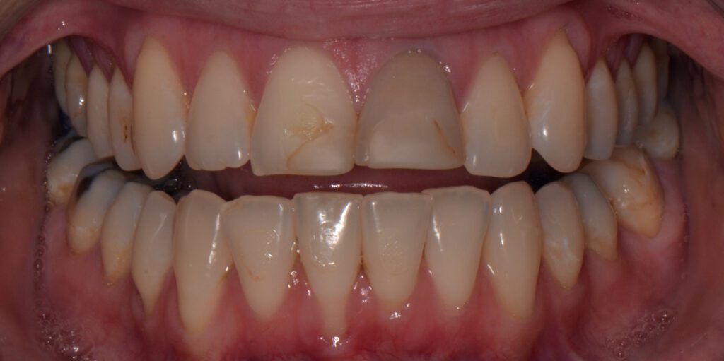 J Before and After Image 1 Great Northern Dental Care