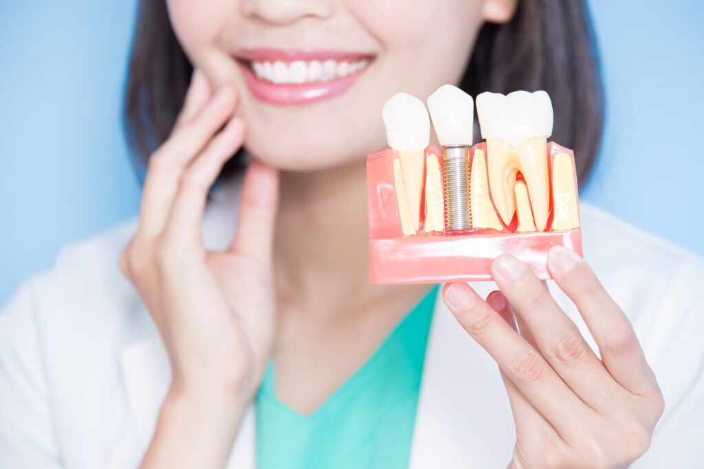 dental implants near me, dentist near whitefish