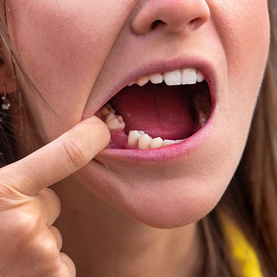 dental implants Kalispell
